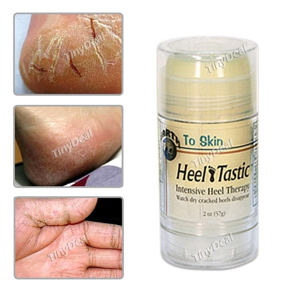 Cracked Heel Tastic Foot Massage Cream Cracked Skin Foot Repair Oil Relieve Chapped Feet Beauty Cream Foot Care