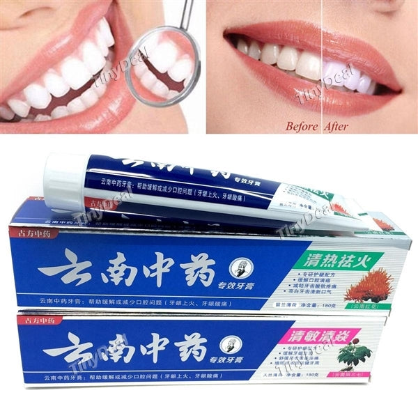 Yunnan Chinese Herbal Toothpaste Gum Bleeding Hemostasis Dental Ulcer Repairing Herbal Toothpaste