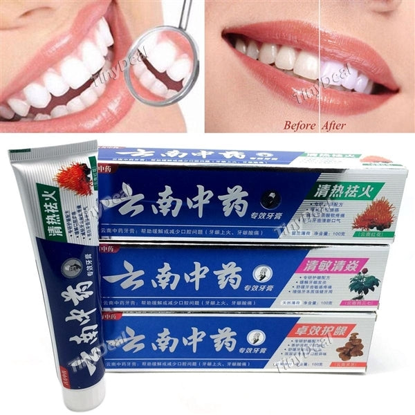 100g Yunnan Chinese Herbal Toothpaste Gum Bleeding Hemostasis Dental Ulcer Repairing Herbal Toothpaste